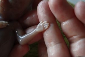 Het opbaren van een foetus in water